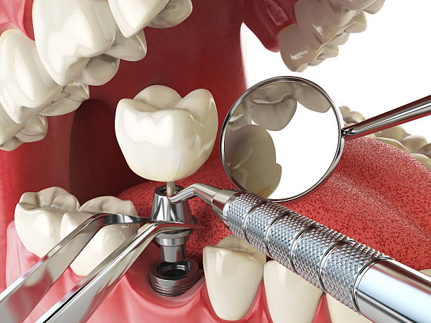 Best Urgent Dental Care for Toothache in Andrews Af, MD