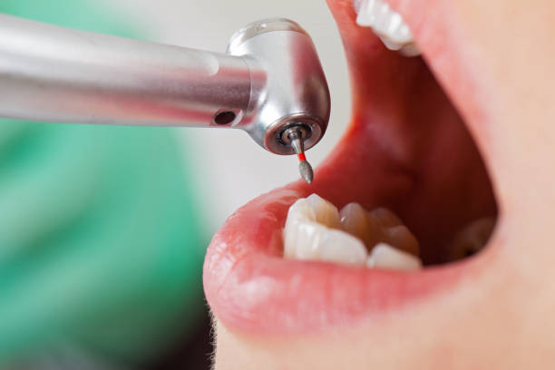 Best Weekend Emergency Dentist in Andrews Af, MD